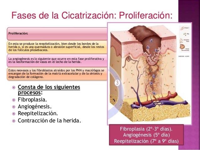Fases De Cicatrización De Una Herida es.slideshare.net