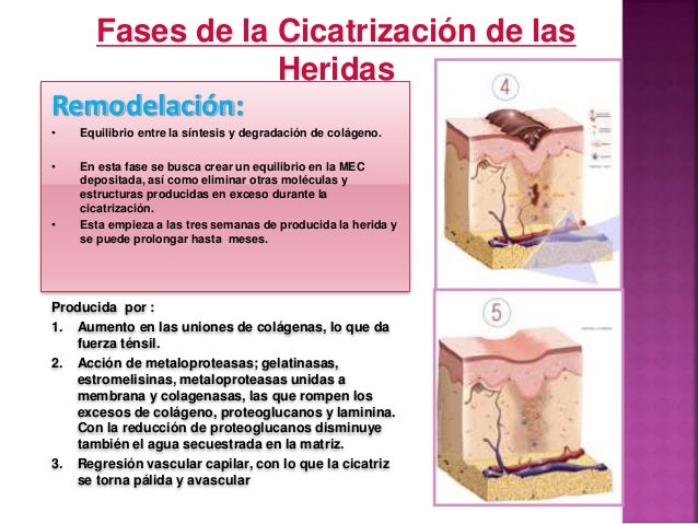 Fases De Cicatrización De Una Herida es.slideshare.net