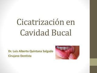 Cicatrización en
Cavidad Bucal
Dr. Luis Alberto Quintana Salgado
Cirujano Dentista
 