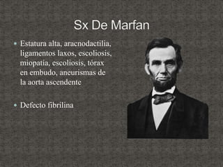  Estatura alta, aracnodactilia,
ligamentos laxos, escoliosis,
miopatía, escoliosis, tórax
en embudo, aneurismas de
la aorta ascendente
 Defecto fibrilina
 