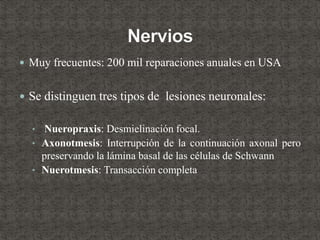  Muy frecuentes: 200 mil reparaciones anuales en USA
 Se distinguen tres tipos de lesiones neuronales:
• Nueropraxis: Desmielinación focal.
• Axonotmesis: Interrupción de la continuación axonal pero
preservando la lámina basal de las células de Schwann
• Nuerotmesis: Transacción completa
 