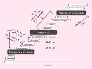 Inflamación y hemostasia
Proliferación
Maduración y Remodelado
1 semana
48-96 Hrs
24-48 Hrs
 