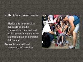  Heridas contaminadas:
Herida que no se realiza
dentro de un medio
controlado ni con material
estéril generalmente ocurren
sin premeditación por parte
del paciente
No contienen material
purulento, inflamación
 
