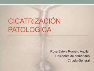 CICATRIZACIÓN
PATOLOGICA

          Rosa Estela Romero Aguilar
             Residente de primer año
                     Cirugía General
 