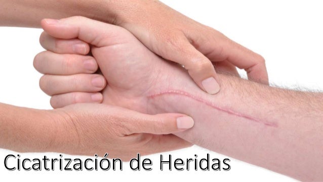 Resultado de imagen para cicatrizacion de heridas