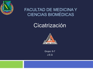 FACULTAD DE MEDICINA Y
CIENCIAS BIOMÉDICAS
Grupo: 6-7
J.E.Q
Cicatrización
 