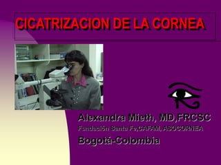 Alexandra Mieth, MD,FRCSC
Fundación Santa Fe,CAFAM, ASOCORNEA
Bogotá-Colombia
CICATRIZACION DE LA CORNEA
 