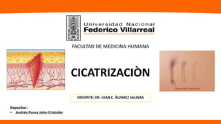 CICATRIZACIÒN
DOCENTE: DR. JUAN C. ÀLVAREZ SALINAS
FACULTAD DE MEDICINA HUMANA
Expositor:
• Andrés Puma John Cristofer
 