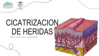 CICATRIZACION
DE HERIDAS
R1CG Castruita Rodriguez
 