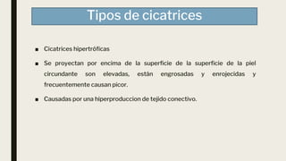 Tipos de cicatrices
■ Cicatrices hipertróficas
■ Se proyectan por encima de la superficie de la superficie de la piel
circundante son elevadas, están engrosadas y enrojecidas y
frecuentemente causan picor.
■ Causadas por una hiperproduccion de tejido conectivo.
 
