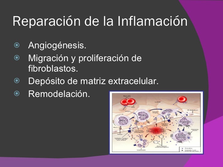 Resultado de imagen para reparacion de inflamacion