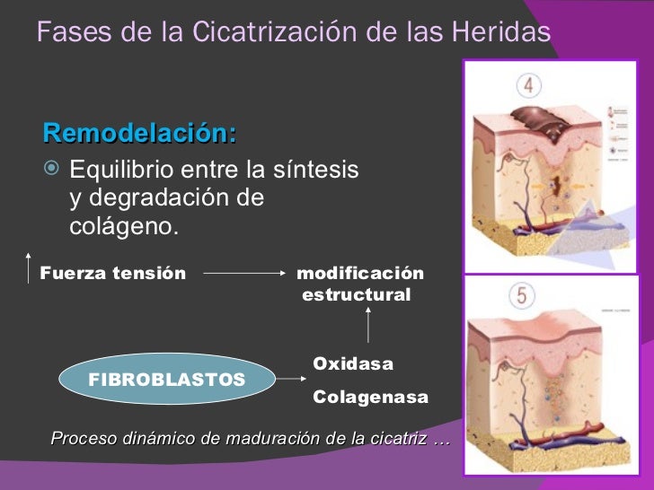 Fases De Cicatrización De Una Herida es.slideshare.net