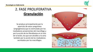 cicatrizacion-de-heridas-pptx