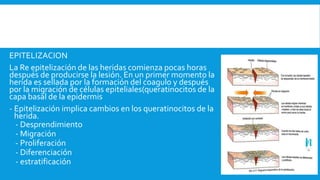 EPITELIZACION
La Re epitelización de las heridas comienza pocas horas
después de producirse la lesión. En un primer momento la
herida es sellada por la formación del coagulo y después
por la migración de células epiteliales(queratinocitos de la
capa basal de la epidermis
- Epitelización implica cambios en los queratinocitos de la
herida.
- Desprendimiento
- Migración
- Proliferación
- Diferenciación
- estratificación
 