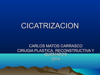 CICATRIZACIONCICATRIZACION
CARLOS MATOS CARRASCOCARLOS MATOS CARRASCO
CIRUGIA PLASTICA, RECONSTRUCTIVA YCIRUGIA PLASTICA, RECONSTRUCTIVA Y
QUEMADOSQUEMADOS
20142014
 