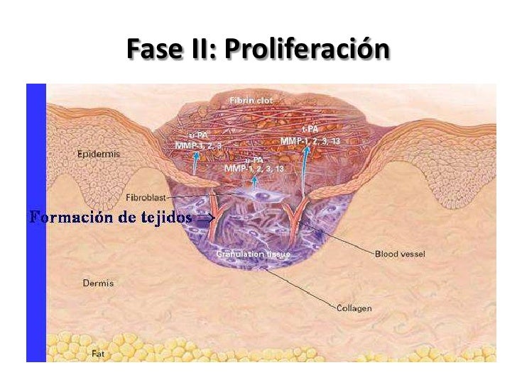 Cicatrización