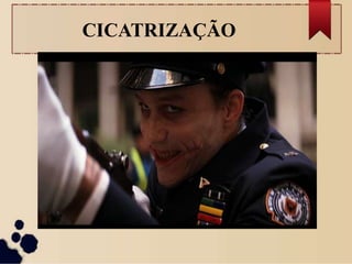 CICATRIZAÇÃO
 