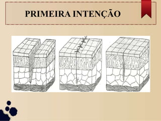 PRIMEIRA INTENÇÃO
 