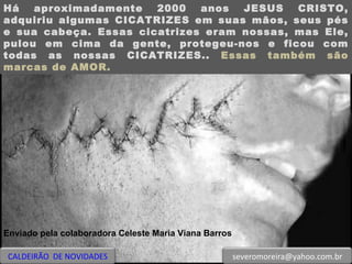 Há aproximadamente 2000 anos JESUS CRISTO, adquiriu algumas CICATRIZES em suas mãos, seus pés e sua cabeça. Essas cicatrizes eram nossas, mas Ele, pulou em cima da gente, protegeu-nos e ficou com todas as nossas CICATRIZES..  Essas também são marcas de AMOR. Enviado pela colaboradora Celeste Maria Viana Barros CALDEIRÃO  DE NOVIDADES [email_address] 