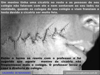 Um menino tinha uma cicatriz no rosto e as pessoas de seu colégio não falavam com ele e nem sentavam ao seu lado; na realidade, quando os colegas de seu colégio o viam franziam a testa devido a cicatriz ser muito feia.  Então a turma se reuniu com o professor e foi sugerido que aquele  menino da cicatriz não freqüentasse mais o colégio. O professor levou o caso à diretoria do colégio. CALDEIRÃO  DE NOVIDADES [email_address] 