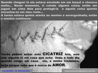 Quando cheguei lá ela estava enrolada em um lençol e chorava muito... Neste momento, vi caindo alguma coisa; então me joguei em cima dela para protegê-la  e aquela coisa quente encostou-se em meu rosto...  A turma estava quieta atenta ao menino e envergonhada; então o menino continuou:  Vocês podem achar esta  CICATRIZ  feia, mas tem alguém lá em casa que acha  linda e todo dia quando chego em casa,  ela, a minha irmãzinha, beija porque sabe que é marca de  AMOR . CALDEIRÃO  DE NOVIDADES [email_address] 