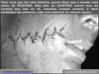 Para você que leu esta história, queria dizer que o mundo está cheio de CICATRIZ. Não falo da CICATRIZ visível mas da cicatriz que não se vê, estamos sempre prontos a abrir cicatrizes nas pessoas, seja com palavras ou nossas ações. CALDEIRÃO  DE NOVIDADES [email_address] 
