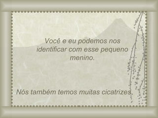 Você e eu podemos nos identificar com esse pequeno menino. Nós também temos muitas cicatrizes. 