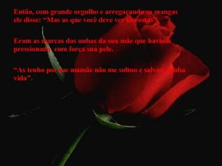 Então, com grande orgulho e arregaçando as mangas  ele disse: “Mas as que você deve ver são estas". Eram as marcas das unhas da sua mãe que haviam pressionado  com força sua pele. “ As tenho porque mamãe não me soltou e salvou minha vida". 