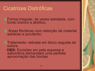 Cicatrizes Distróficas Forma irregular, ás vezes estrelada, com fundo branco e atrófico; Àreas fibróticas com retenção de material sebáceo e purulento; Tratamento: retirada em bloco seguida de sutura. OBS:  Excisões em pele espessa e seborréica demandam uma perfeita aproximação das bordas. 