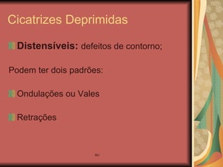Cicatrizes Deprimidas Distensíveis:   defeitos de contorno; Podem ter dois padrões: Ondulações ou Vales Retrações 