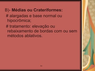 B)-  Médias ou Crateriformes: # alargadas e base normal ou hipocrômica; # tratamento: elevação ou rebaixamento de bordas com ou sem métodos ablativos. 