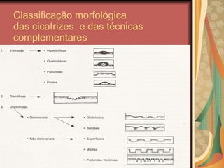 Classificação morfológica das cicatrizes  e das técnicas  complementares 