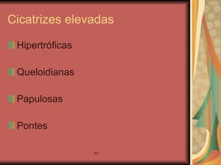 Cicatrizes elevadas Hipertróficas Queloidianas Papulosas Pontes 