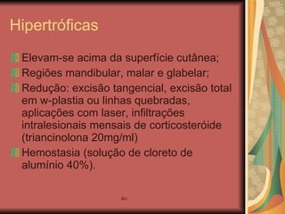 Hipertróficas Elevam-se acima da superfície cutânea; Regiões mandibular, malar e glabelar; Redução: excisão tangencial, excisão total em w-plastia ou linhas quebradas, aplicações com laser, infiltrações intralesionais mensais de corticosteróide (triancinolona 20mg/ml) Hemostasia (solução de cloreto de alumínio 40%). 