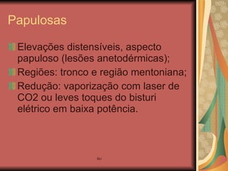 Papulosas Elevações distensíveis, aspecto papuloso (lesões anetodérmicas); Regiões: tronco e região mentoniana; Redução: vaporização com laser de CO2 ou leves toques do bisturi elétrico em baixa potência. 