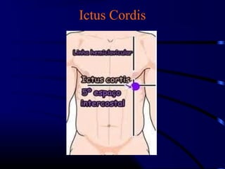 Ictus Cordis
 