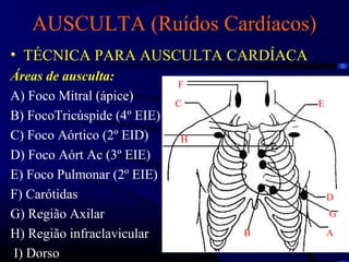 AUSCULTA (Ruídos Cardíacos)
• TÉCNICA PARA AUSCULTA CARDÍACA
Áreas de ausculta:
A) Foco Mitral (ápice)
B) FocoTricúspide (4º EIE)
C) Foco Aórtico (2º EID)
D) Foco Aórt Ac (3º EIE)
E) Foco Pulmonar (2º EIE)
F) Carótidas
G) Região Axilar
H) Região infraclavicular
I) Dorso
A
AAB
G
C
D
F
H
E
 