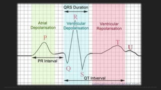 Jose Pedro Patritti, Jorge Hugo Liguizamon, Carlos Alvarez Iorio, Ricardo Piche, Hugo Londero y Luis M. de la Fuente; Función ventricular izquierda en la cardiopatía isquémica; Rev Arg Cardiol; 46 No (6); 393-441
 
