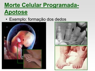 Morte Celular Programada-
Apotose
• Exemplo: formação dos dedos
 