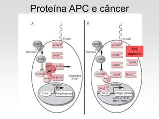 Proteína APC e câncer
APC
mutante
 
