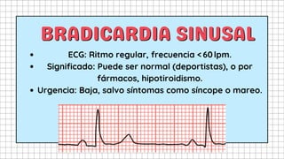Tipos de Ritmos Cardíacos Anormales y Ciclos del Corazón Explicados | PDF