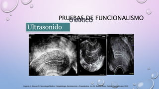 PRUEBAS DE FUNCIONALISMOOVARICO
Ultrasonido
Argente H, Alvarez M. Semiologia Medica: Fisiopatologia, Semiotecnica y Propedeutica. 1ra Ed. Buenos Aires: Medica Panamericana, 2010
 