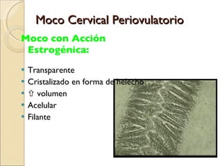 Moco Cervical Periovulatorio Moco con Acción Estrogénica: Transparente Cristalizado en forma de helecho    volumen Acelular  Filante 