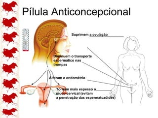 Pílula Anticoncepcional Suprimem a ovulação Diminuem o transporte espermático nas trompas Alteram o endométrio Tornam mais espesso o muco cervical (evitam a penetração das espermatozóides) 
