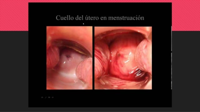 Ciclo menstrual