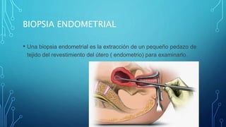 BIOPSIA ENDOMETRIAL
• Una biopsia endometrial es la extracción de un pequeño pedazo de
tejido del revestimiento del útero ( endometrio) para examinarlo.
 