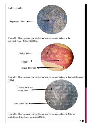 Ciclos de vida




  Espermatezóides




Figura 10- Observação ao microscópio de uma preparação definitiva de
espermatezóides de touro (1000x).




           Oócito


              Fóliculo

              Parede do ovário



Figura 11- Observação ao microscópio de uma preparação definitiva de ovário humano
(400x).


          Células dos tubos
          seminíferos




      Tubo seminífero



Figura 12- Observação ao microscópio de uma preparação definitiva de tubos
seminíferos de testículos humanos (150x).
                                                                               9
                                                                              10
 