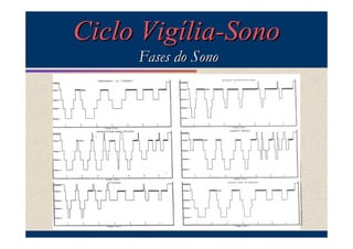 Ciclo Vigília-Sono
     Fases do Sono
 