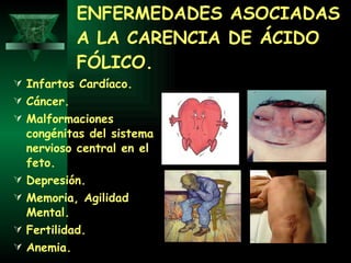 ENFERMEDADES ASOCIADAS A LA CARENCIA DE ÁCIDO FÓLICO. Infartos Cardíaco. Cáncer. Malformaciones congénitas del sistema nervioso central en el feto. Depresión. Memoria, Agilidad Mental. Fertilidad. Anemia.  