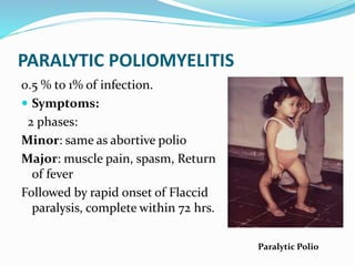 PARALYTIC POLIOMYELITIS
0.5 % to 1% of infection.
 Symptoms:
2 phases:
Minor: same as abortive polio
Major: muscle pain, spasm, Return
of fever
Followed by rapid onset of Flaccid
paralysis, complete within 72 hrs.
Paralytic Polio
 